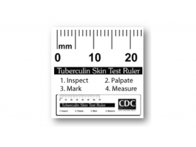 Free Tuberculin Skin Testing Ruler By CDC!